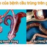 vantrang99
